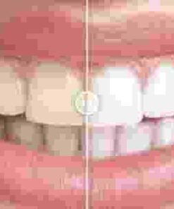 Before & After Images Comparison WordPress Plugin GPL